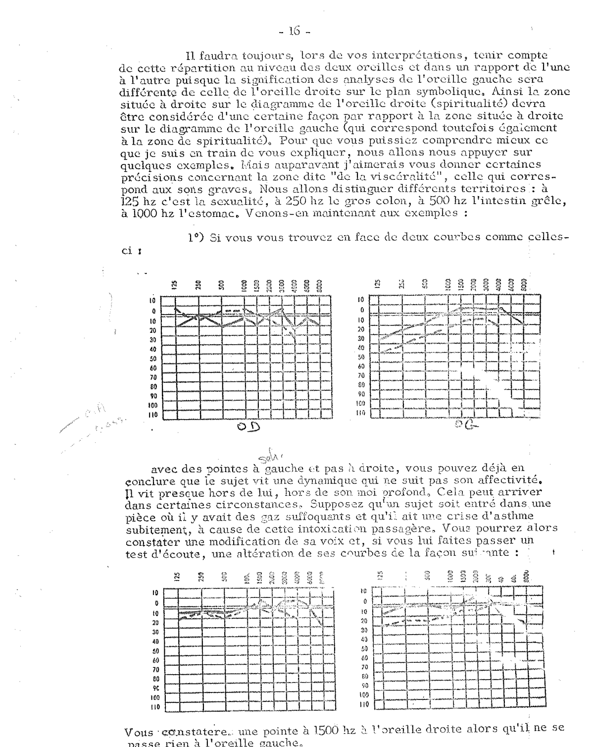 Peak at 250 Hz — colon disorder