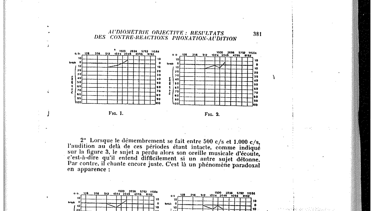 Fig. 1 et Fig. 2 — Audiogrammes de référence : ascension régulière de 500 à 2 00
