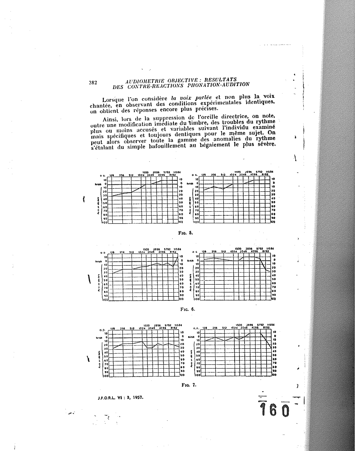 Fig. 5, Fig. 6 et Fig. 7 — Séries audiométriques comparatives illustrant les ano